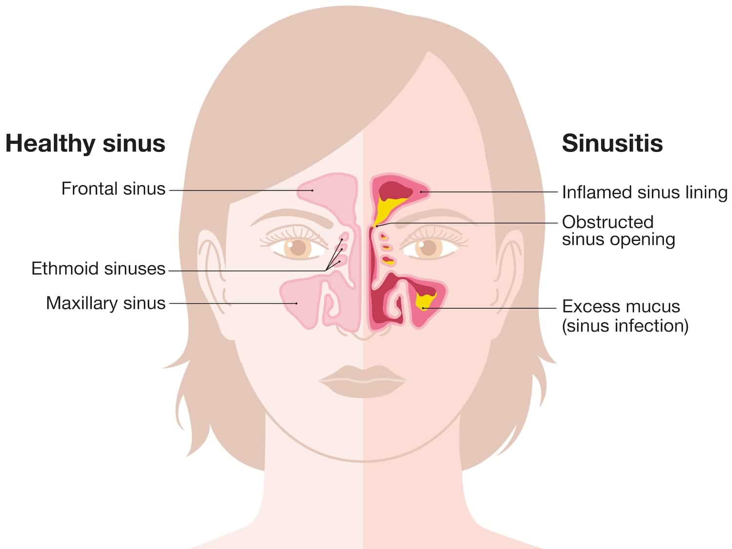 Healthy Sinus