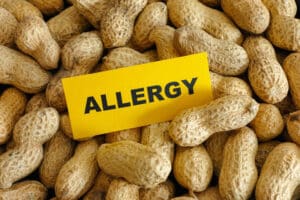 peanut Allergy